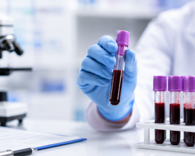 Laboratory specialist examining blood samples for early blood cancer diagnosis using advanced hematology testing