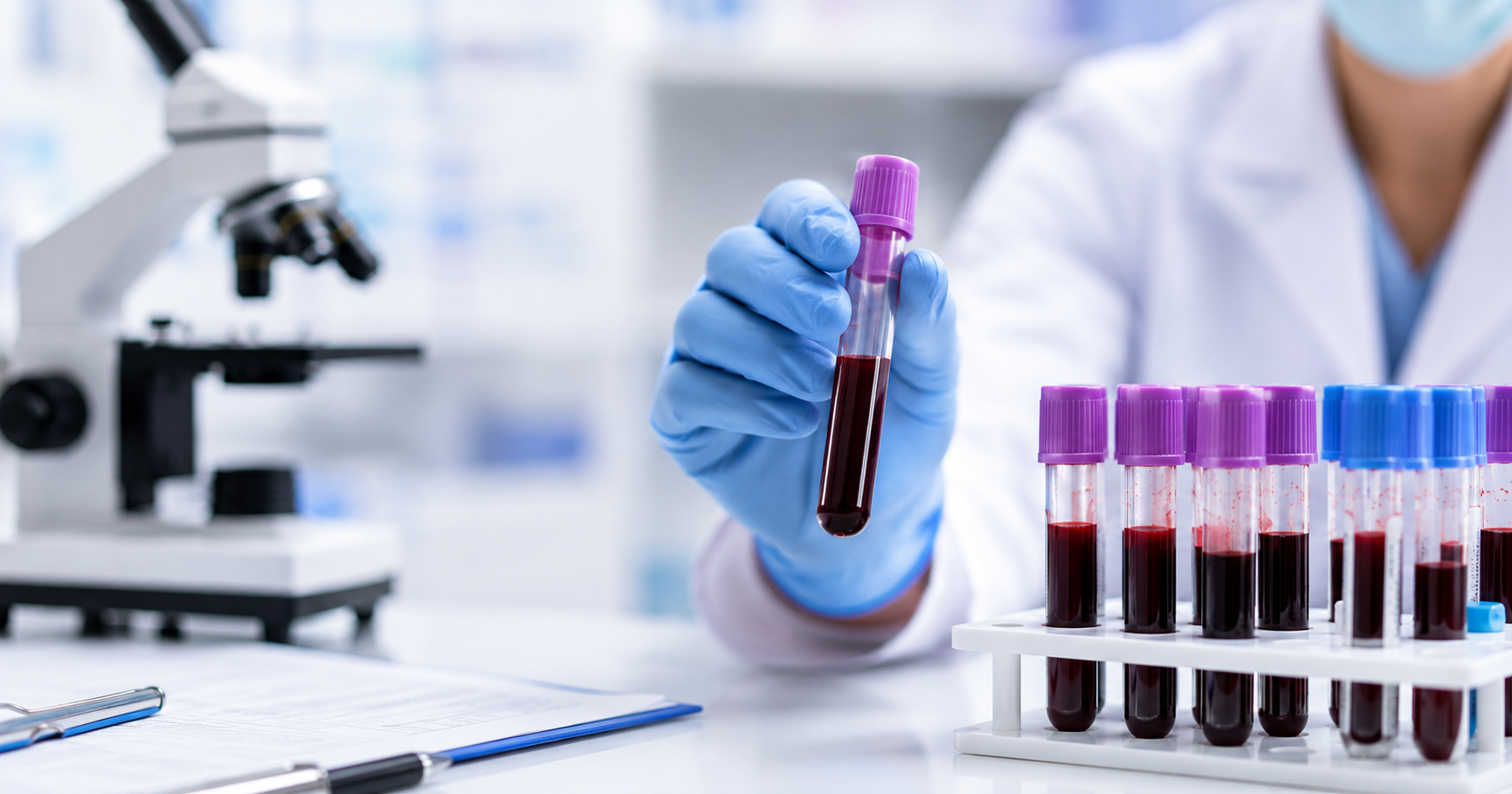 Laboratory specialist examining blood samples for early blood cancer diagnosis using advanced hematology testing